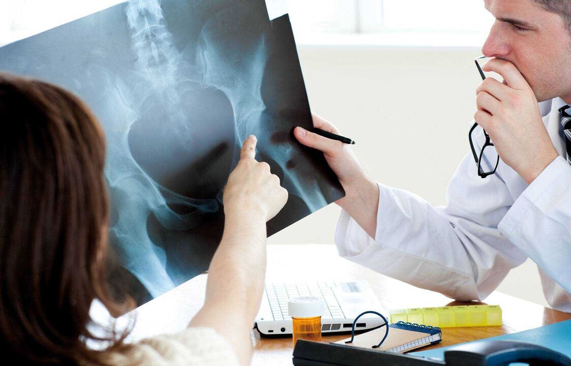 médicos examinando raio-x para artrose do quadril