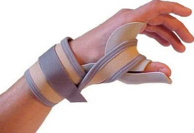 Fixação do polegar da mão por lesão